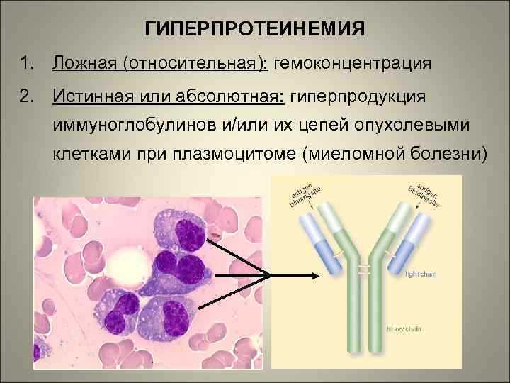 ГИПЕРПРОТЕИНЕМИЯ 1. Ложная (относительная): гемоконцентрация 2. Истинная или абсолютная: гиперпродукция иммуноглобулинов и/или их цепей