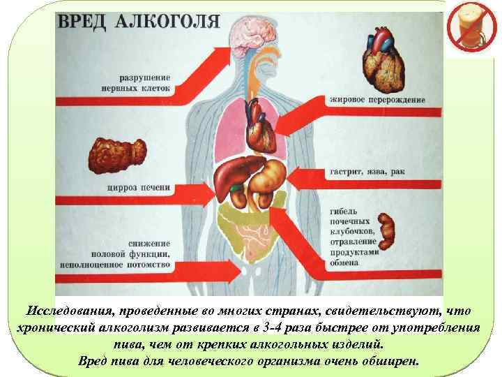 Исследования, проведенные во многих странах, свидетельствуют, что хронический алкоголизм развивается в 3 -4 раза