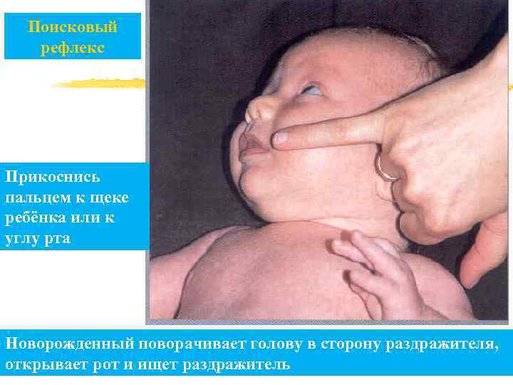 Поисковый рефлекс Прикоснись пальцем к щеке ребёнка или к углу рта Новорожденный поворачивает голову