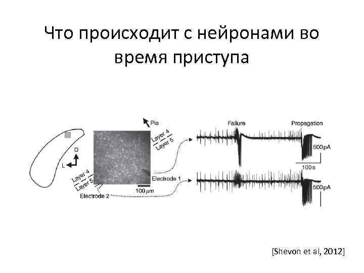 Что происходит с нейронами во время приступа [Shevon et al, 2012] 