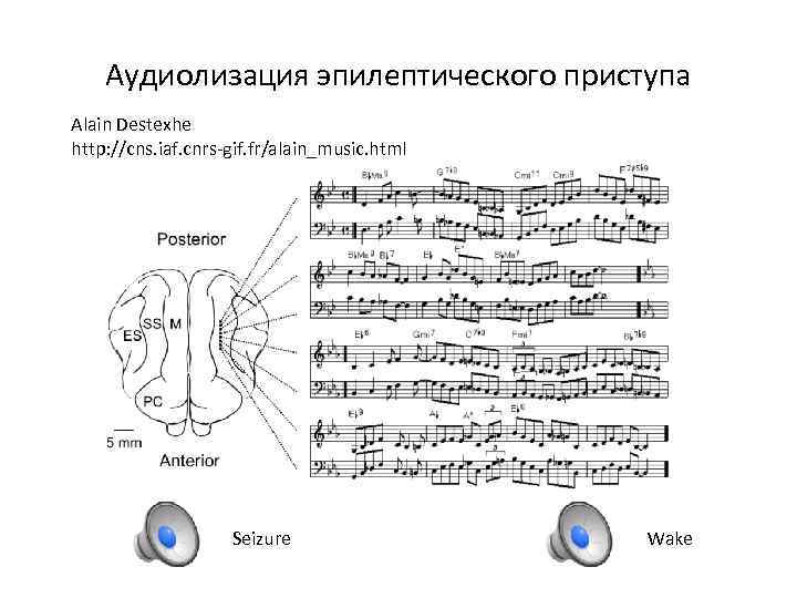 Аудиолизация эпилептического приступа Alain Destexhe http: //cns. iaf. cnrs-gif. fr/alain_music. html Seizure Wake 