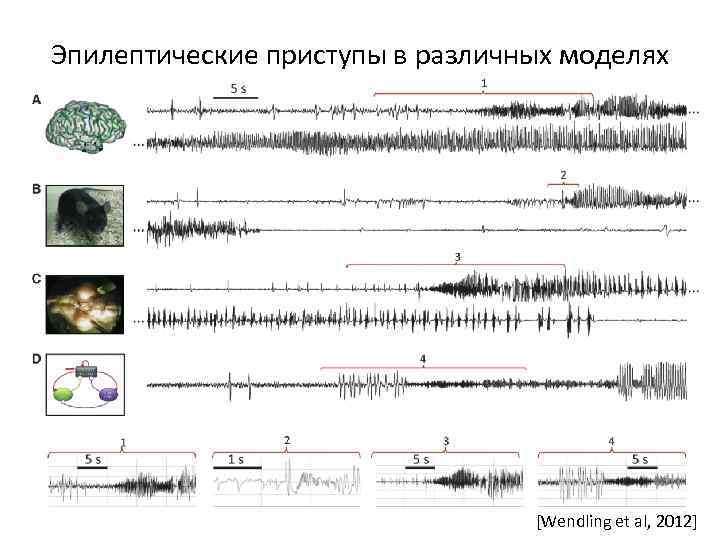 Эпилептические приступы в различных моделях [Wendling et al, 2012] 