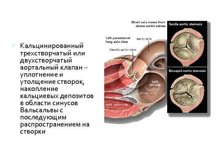 Где расположен трехстворчатый клапан