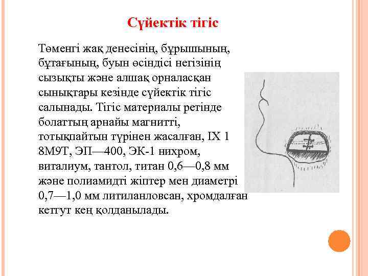 Сүйектік тігіс Төменгі жақ денесінің, бұрышының, бұтағының, буын өсіндісі негізінің сызықты және алшақ орналасқан