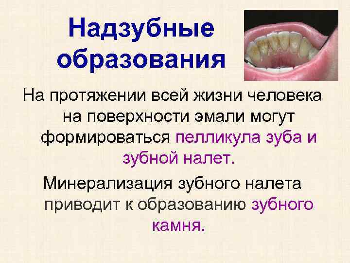 Надзубные образования На протяжении всей жизни человека на поверхности эмали могут формироваться пелликула зуба