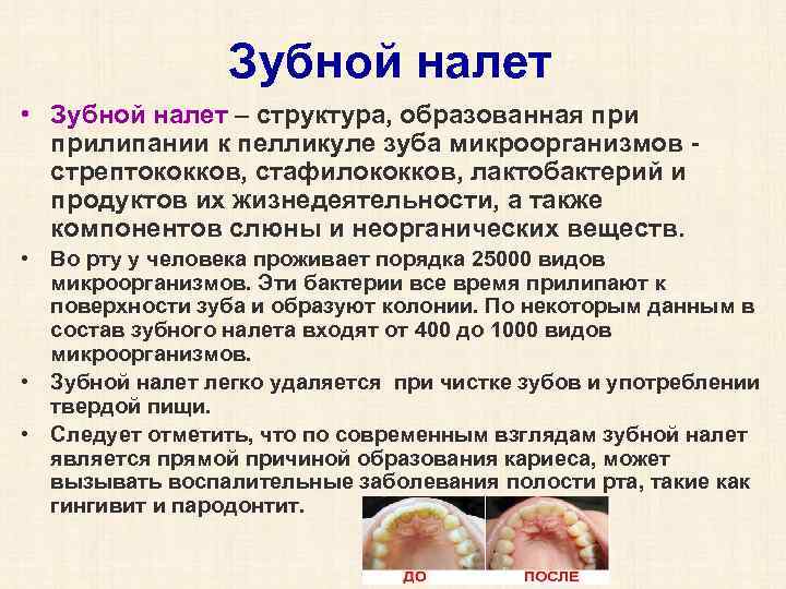 Зубной налет • Зубной налет – структура, образованная прилипании к пелликуле зуба микроорганизмов стрептококков,