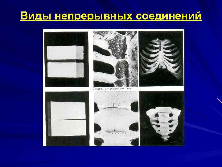 Виды непрерывных соединений 