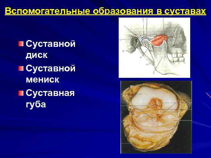 Вспомогательные образования в суставах Суставной диск Суставной мениск Суставная губа 