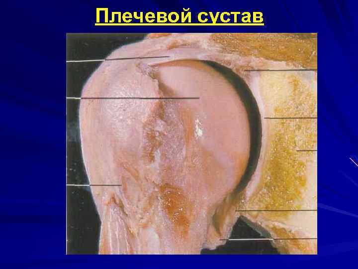Плечевой сустав 