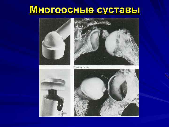 Многоосные суставы 