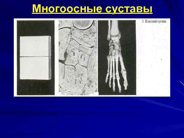 Многоосные суставы 