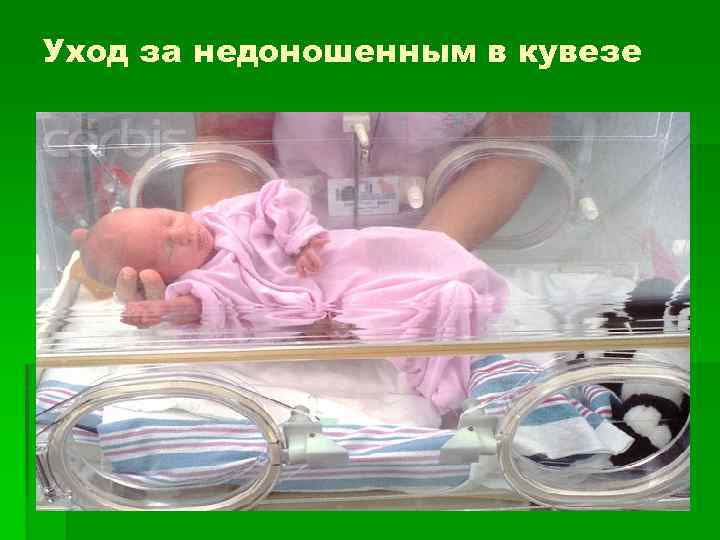Уход за недоношенным в кувезе 