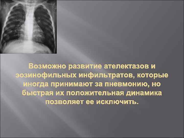 Возможно развитие ателектазов и эозинофильных инфильтратов, которые иногда принимают за пневмонию, но быстрая их
