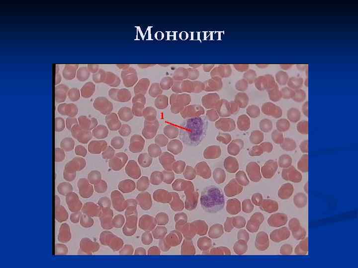 Моноцит 