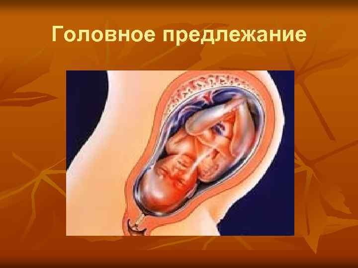 Головное предлежание 