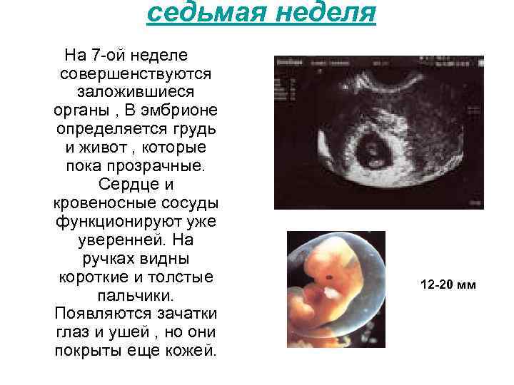 седьмая неделя На 7 -ой неделе совершенствуются заложившиеся органы , В эмбрионе определяется грудь