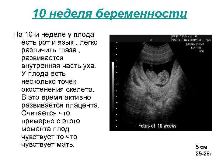 12 дней беременности. Размер ребёнка на 10 неделе беременности. 10 Недель беременности развитие. Размер эмбриона в 10 недель.