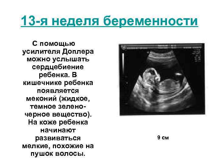 12 недель ударов в минуту. Сердцебиение плода на УЗИ. 6 Неделя беременности сердцебиение ребенка. УЗИ 12 недель беременности сердцебиение плода. Сердцебиение плода на 13 неделе беременности.