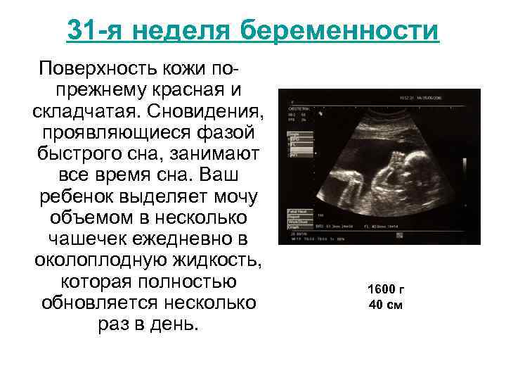 31 -я неделя беременности Поверхность кожи попрежнему красная и складчатая. Сновидения, проявляющиеся фазой быстрого