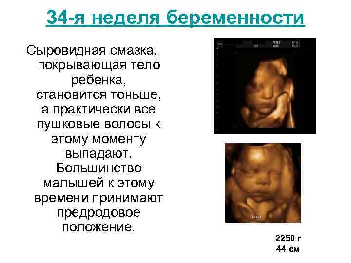 34 -я неделя беременности Сыровидная смазка, покрывающая тело ребенка, становится тоньше, а практически все