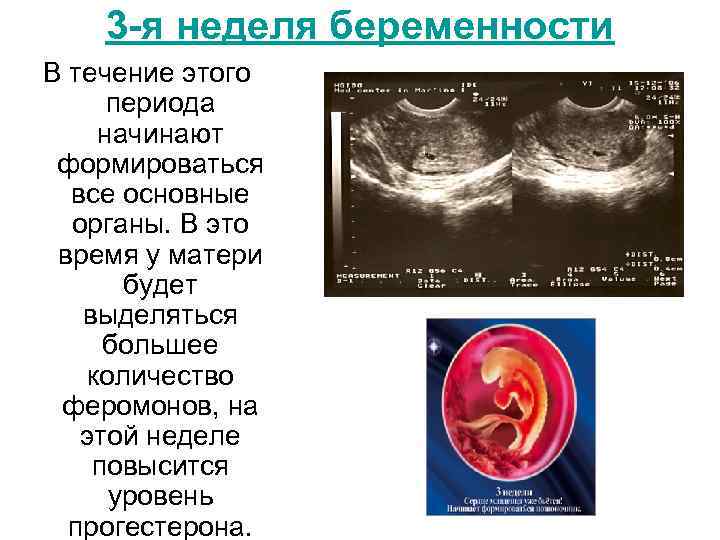 3 -я неделя беременности В течение этого периода начинают формироваться все основные органы. В