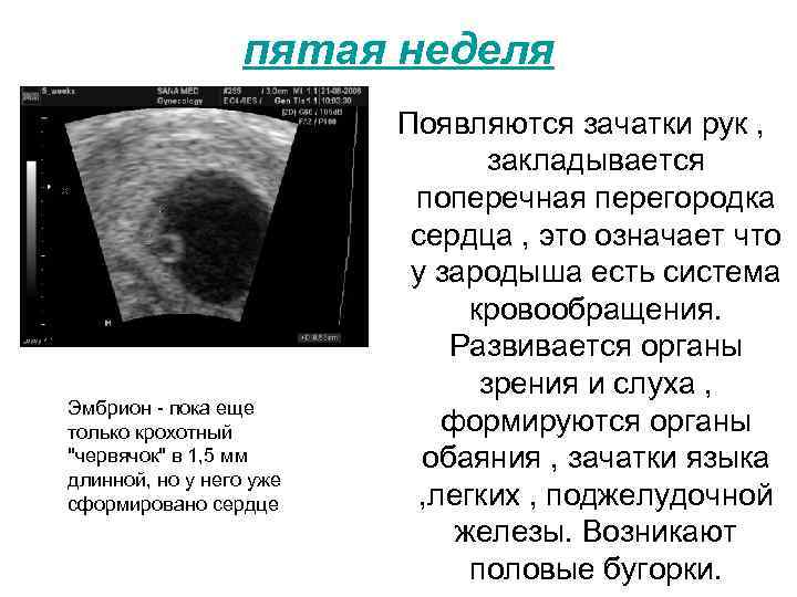 пятая неделя Эмбрион - пока еще только крохотный "червячок" в 1, 5 мм длинной,