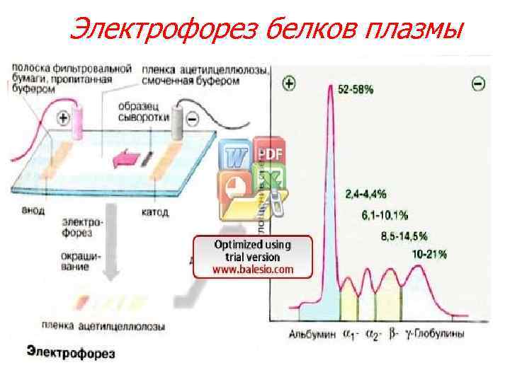 Электрофорез белков плазмы 