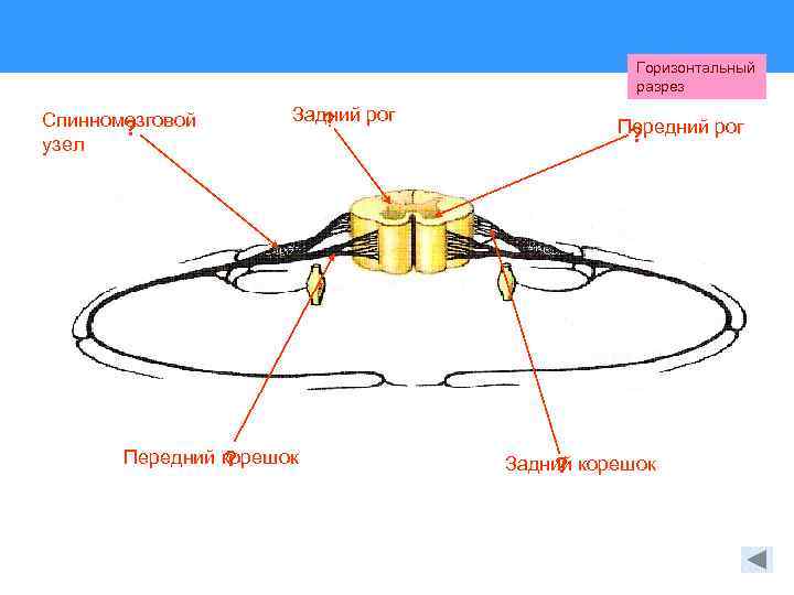 Горизонтальный разрез Спинномозговой ? узел Задний рог ? Передний корешок ? Передний рог ?