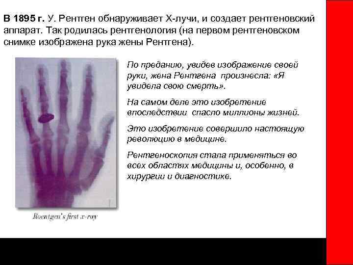 В 1895 г. У. Рентген обнаруживает Х-лучи, и создает рентгеновский аппарат. Так родилась рентгенология