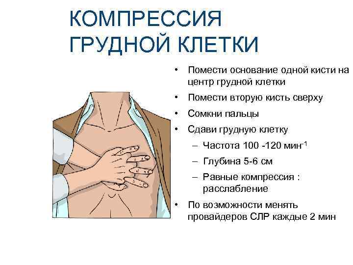 КОМПРЕССИЯ ГРУДНОЙ КЛЕТКИ • Помести основание одной кисти на центр грудной клетки • Помести