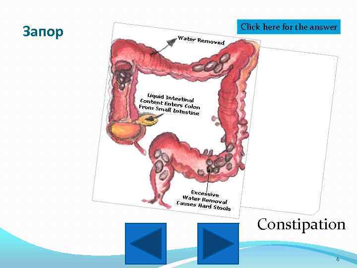 Запор Click here for the answer Constipation 6 