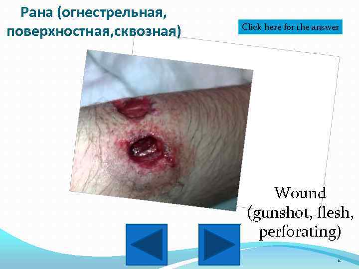 Рана (огнестрельная, поверхностная, сквозная) Click here for the answer Wound (gunshot, flesh, perforating) 11