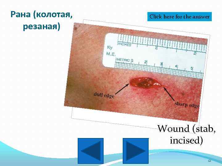 Рана (колотая, резаная) Click here for the answer Wound (stab, incised) 12 