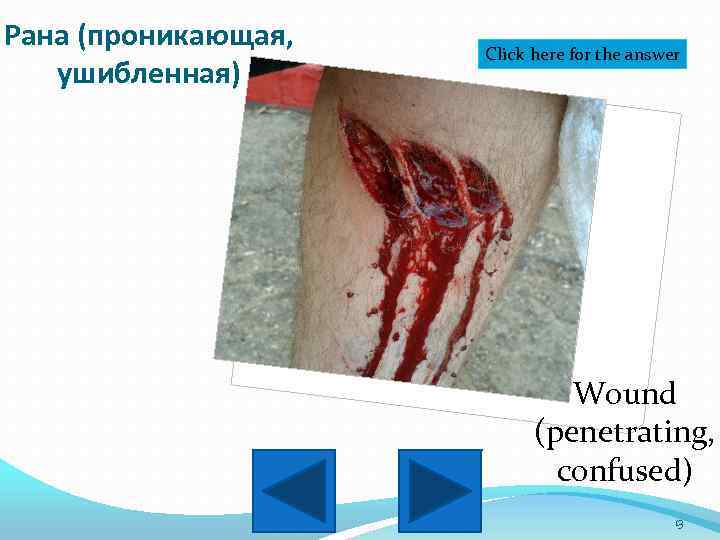 Рана (проникающая, ушибленная) Click here for the answer Wound (penetrating, confused) 13 