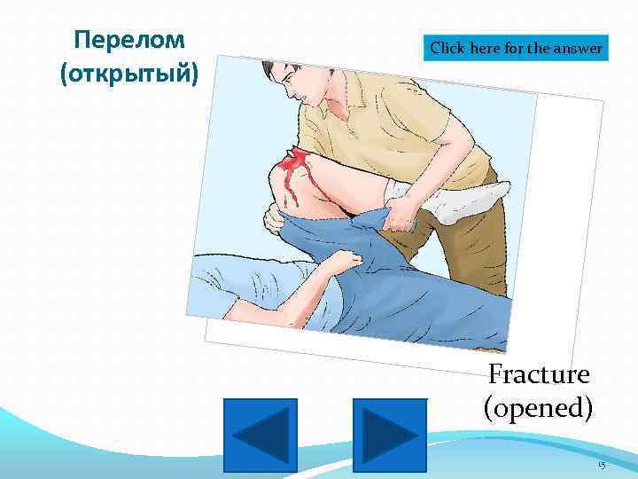 Перелом (открытый) Click here for the answer Fracture (opened) 15 