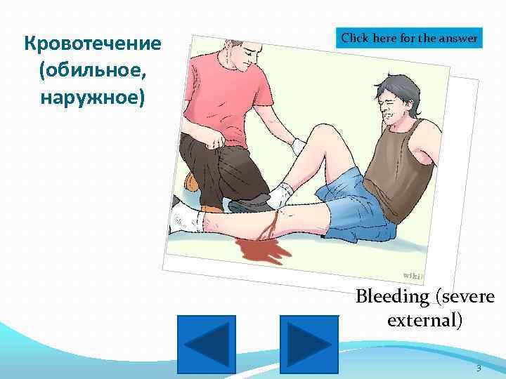 Кровотечение (обильное, наружное) Click here for the answer Bleeding (severe external) 3 