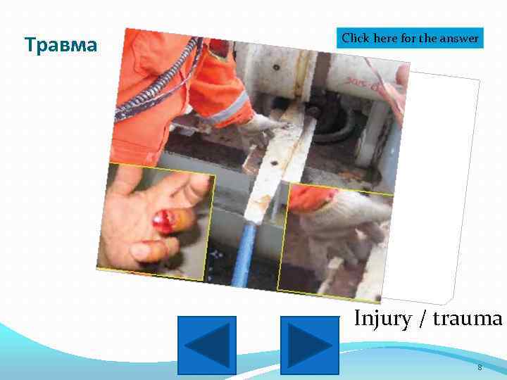 Травма Click here for the answer Injury / trauma 8 