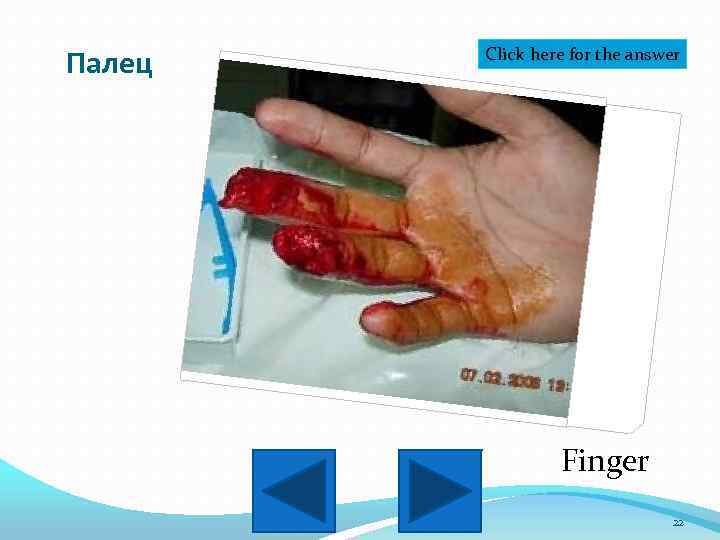 Палец Click here for the answer Finger 22 