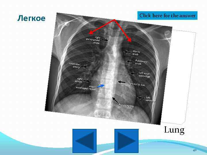 Легкое Click here for the answer Lung 40 
