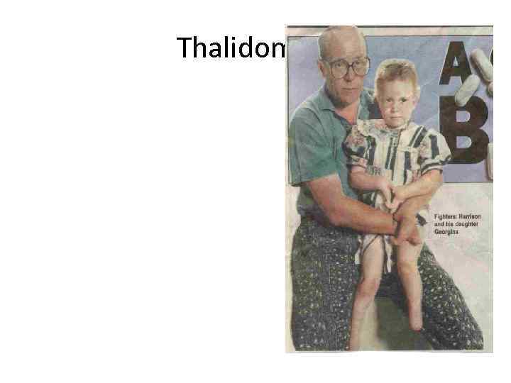 Thalidomide • Early 1960’s given to pregnant women to treat morning sickness • Later