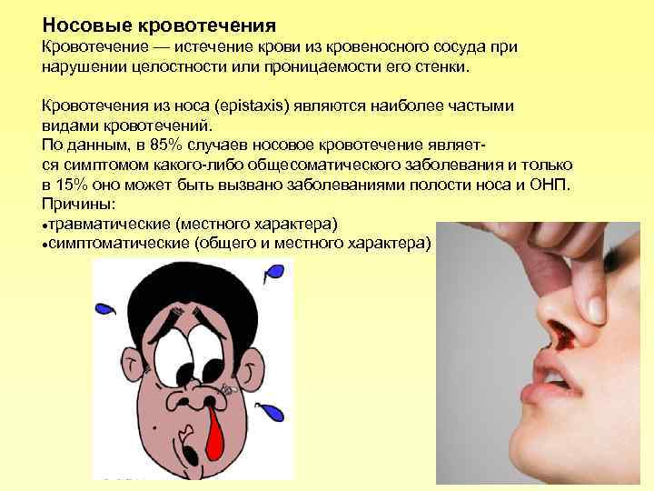Причины частого кровотечения из носа. Наиболее частая причина носового кровотечения. Нососове кровотечение. Типы носовых кровотечений.