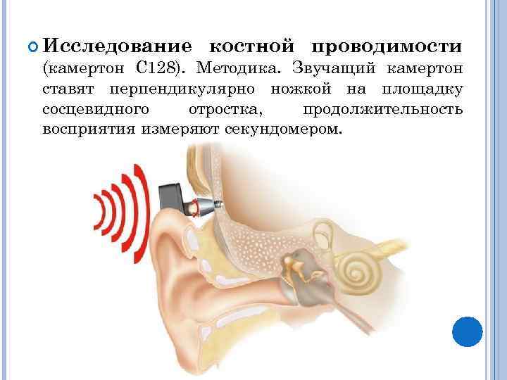  Исследование костной проводимости (камертон С 128). Методика. Звучащий камертон ставят перпендикулярно ножкой на