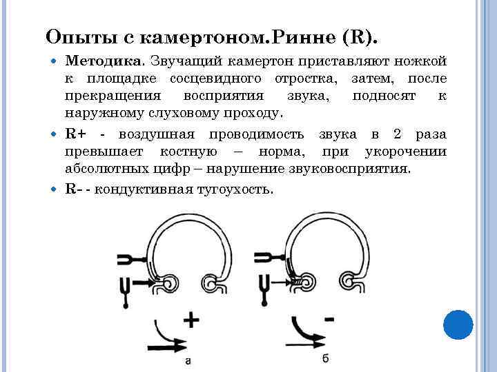 Опыты с камертоном. Ринне (R). Методика. Звучащий камертон приставляют ножкой к площадке сосцевидного отростка,