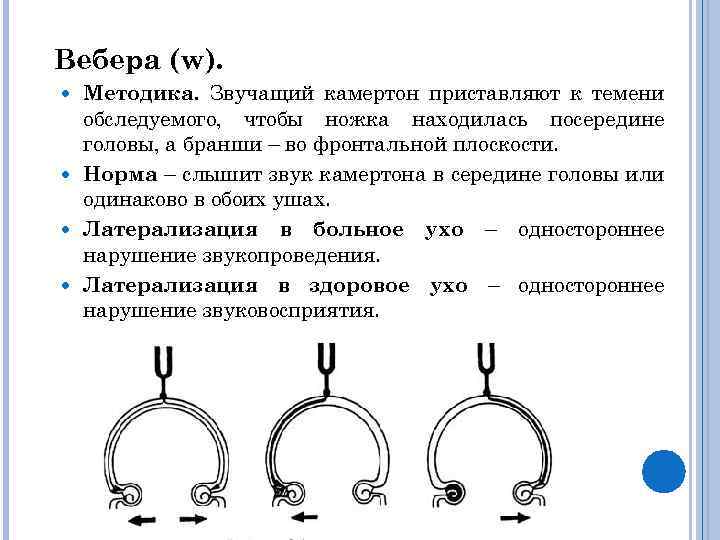 Вебера (w). Методика. Звучащий камертон приставляют к темени обследуемого, чтобы ножка находилась посередине головы,