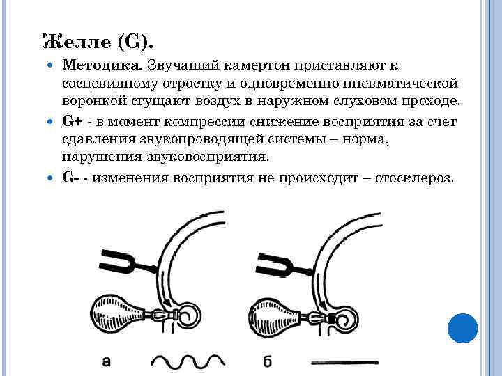 Желле (G). Методика. Звучащий камертон приставляют к сосцевидному отростку и одновременно пневматической воронкой сгущают