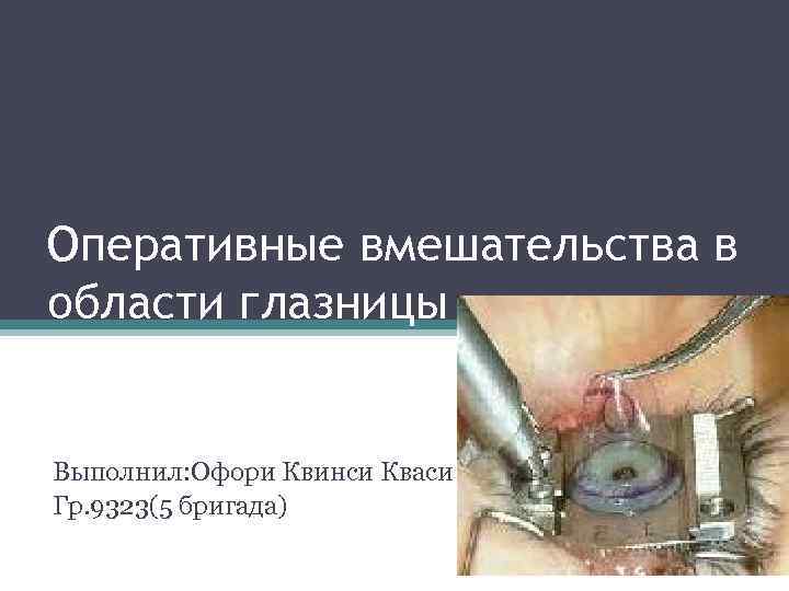 Оперативные вмешательства в области глазницы Выполнил: Офори Квинси Кваси Гр. 9323(5 бригада) 