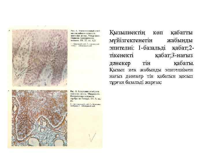 Қызылиектің көп қабатты мүйізгектенетін жабынды эпителиі: 1 -базальді қабат; 2 тікенекті қабат; 3 -нағыз