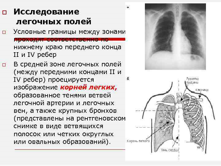 Поля легких. Легочные поля. Среднее легочное поле. Отделы легочных полей. Легочные поля границы.