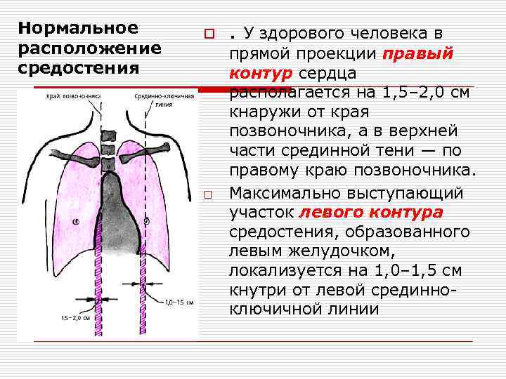 Нормальное расположение