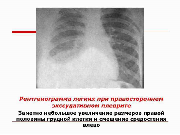 План описания рентгенограммы легких